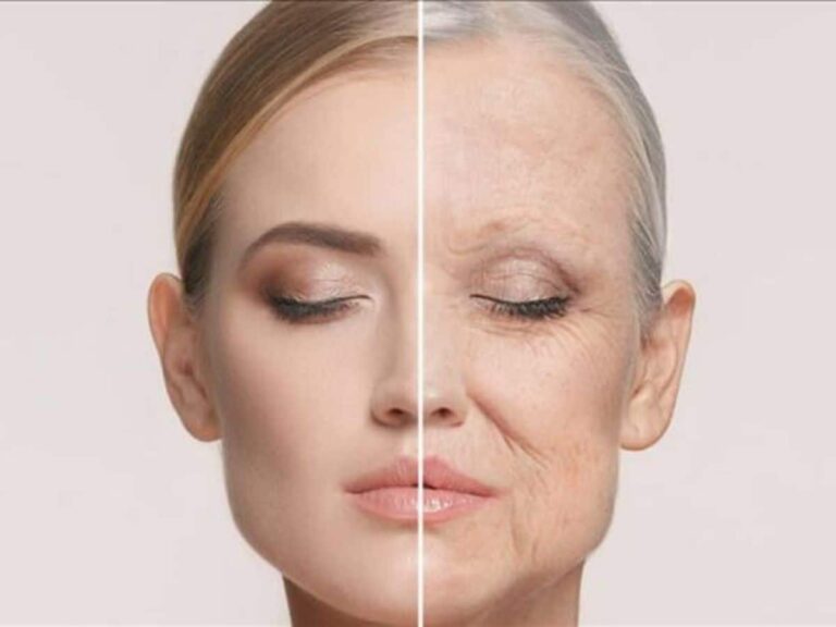 Premature-Aging-causes