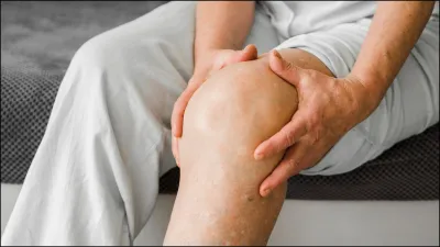 arthritis-pain-18-04-2024-1713409657